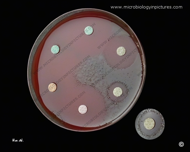 testing of antibiotic susceptibility of streptococccus pneumoniae